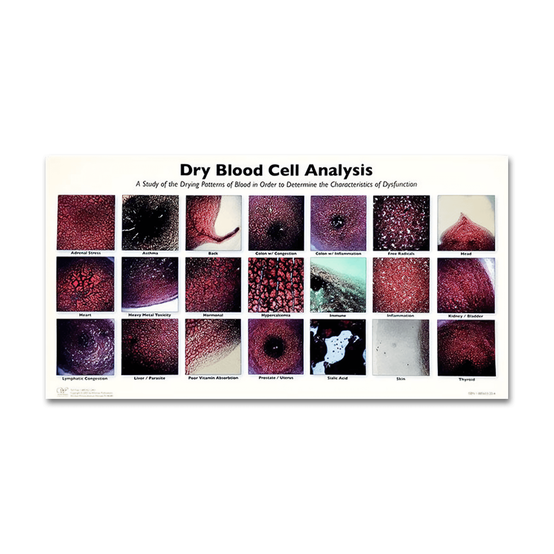 Dried Blood Cell Analysis Chart