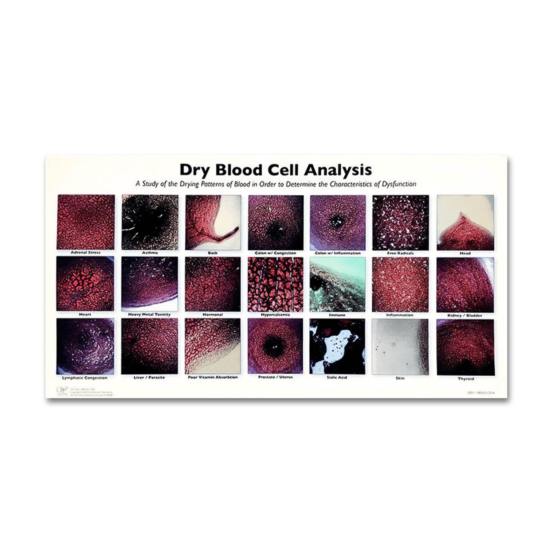 Dried Blood Cell Analysis Chart - Nutritional Resources
